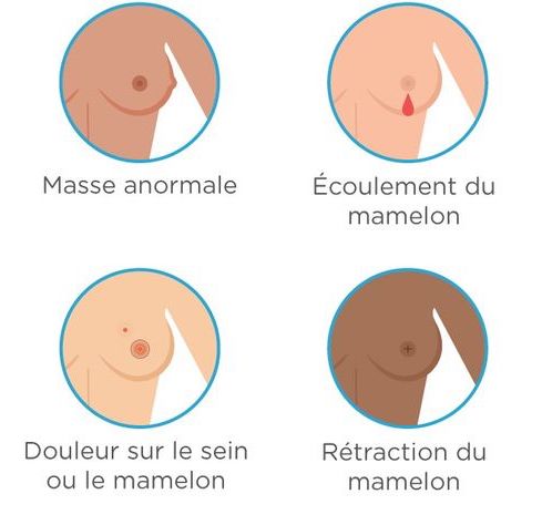 Breast Cancer 2_fr